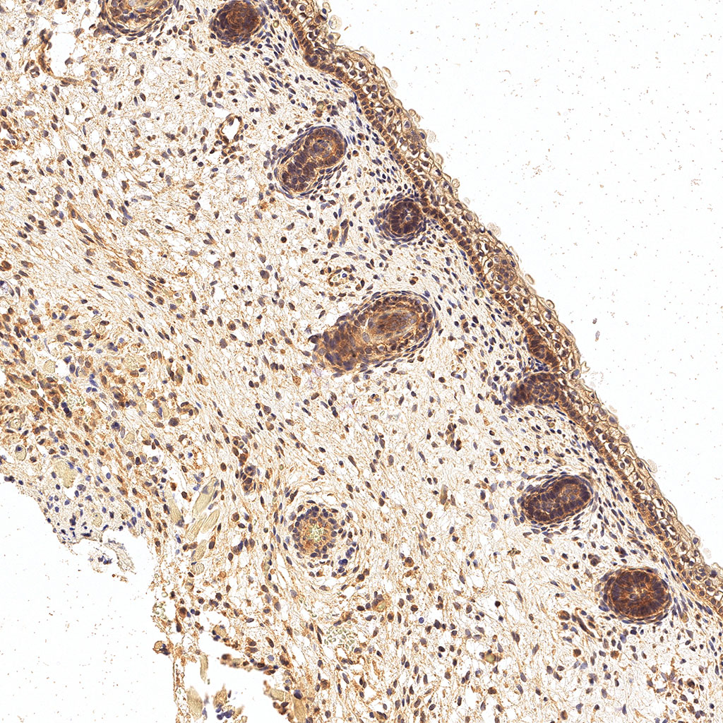 sars-cov-2 gene expression in a human fetus